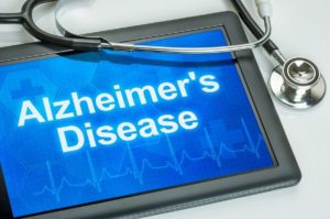 Elder Care San Antonio TX - 3 Important Considerations When an Aging Parent Is Diagnosed with Alzheimer’s